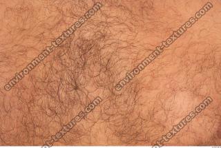 human skin hairy 0007